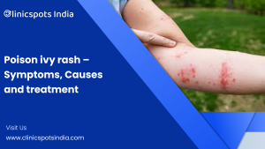 Our Blogs Poison ivy rash